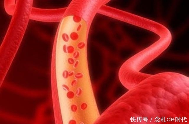 早餐|体检甘油三酯4.56,和早餐吃鸡蛋、牛奶或豆浆的关系有多大?