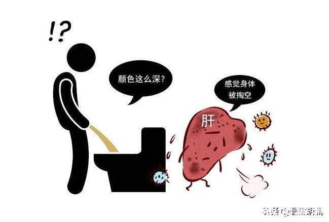 肝脏|肝脏作用非凡!身体出现这6种情况,多是肝脏出问题了