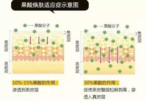 一篇教你读懂什么是果酸焕肤