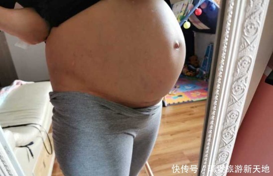 妈妈们|准妈妈疏忽细节，四维彩超做了3次，可长点心吧！