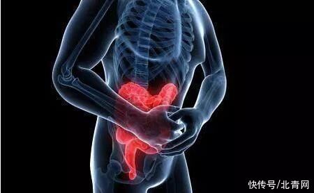 急性发作|溃疡性结肠炎患者日常生活中应注意哪些方面?