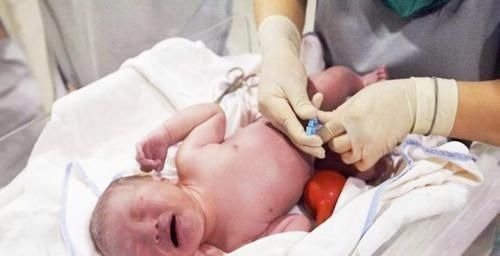 分娩|宝宝头部被剖腹产划伤,凭啥不算“事故”院方的回应很有道理