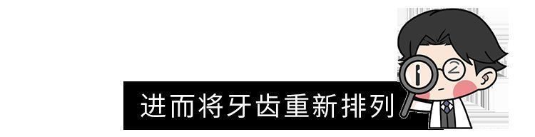 矫正|为什么只要戴牙套，牙齿就可以恢复得很整齐？生动展示矫正过程