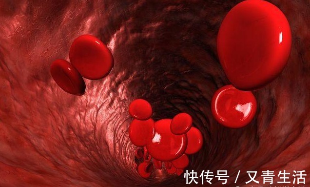 头晕头痛|血液黏稠的人，脸上一般有4个表现，若没有，说明血管还不算太堵