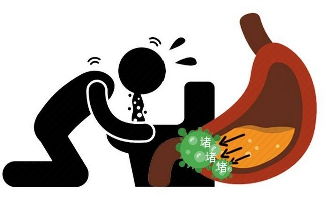 缺血性脑卒中|脑梗来袭，头部先知，医生：晨起头部出现3种症状，越快检查越好