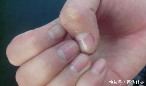 大分子|从双手就能判断女性气血是否足，3个方法补血快速养出好气色