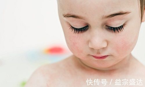 迟缓|八个月宝宝发育迟缓,罪魁祸首竟是一款宝宝霜!专家:家长需警惕