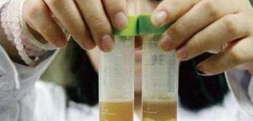 糖友|男子患糖尿病30年，没有并发症，他给出4点降糖秘籍，早看早受益