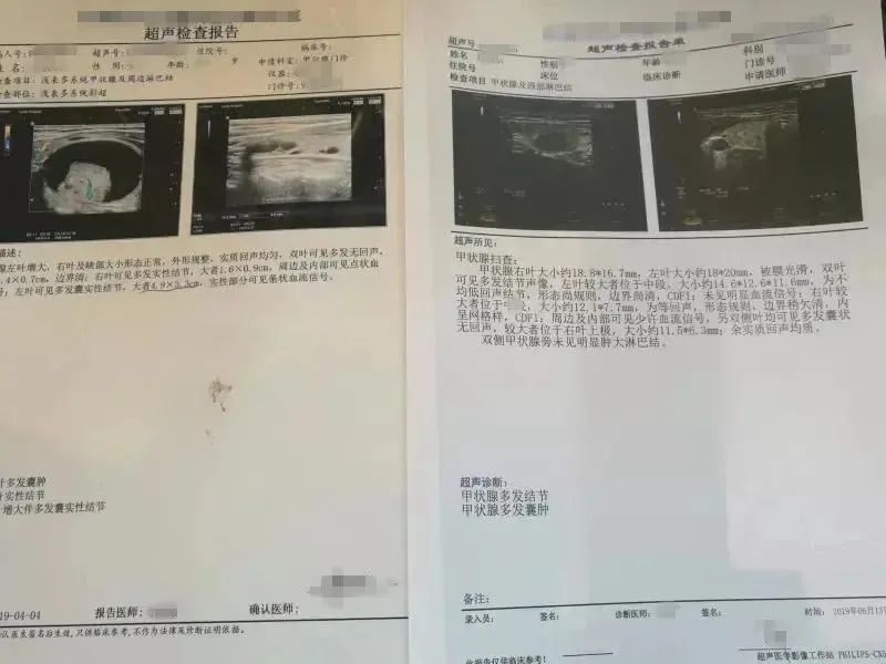 翟主任|有甲状腺结节的人，少吃这3种食物！结节3个月缩小，关键用了这个方法！