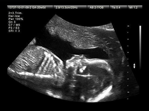 宝妈|十月怀胎要做多少次产检每次查些啥注意啥准备啥最全指南