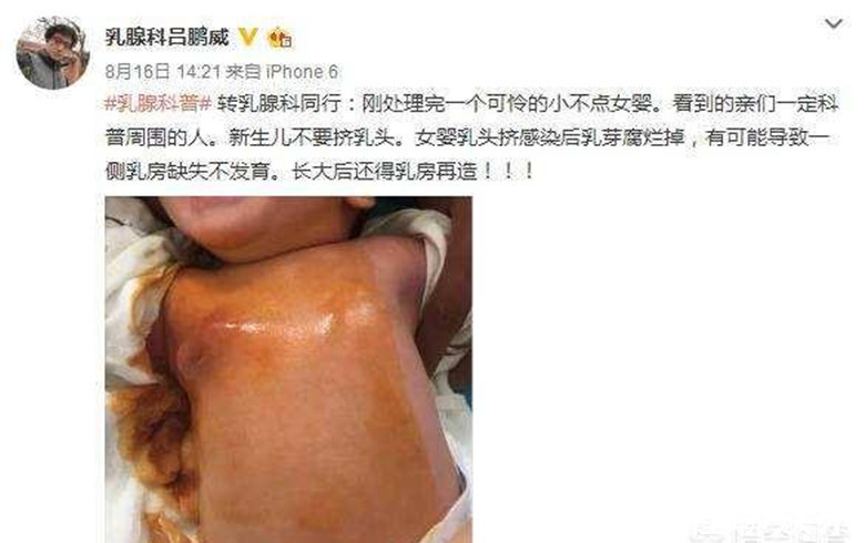 奶粉|不要对新生儿做这11件事,第5和第8尤其要注意!