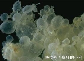 刘芳|女子待产旬月因一口凉水发现未孕,医院检查结果更让人崩溃恐惧