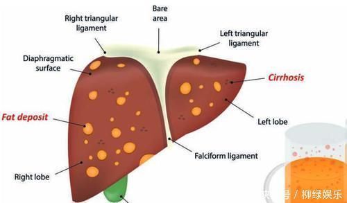 劝告:长期喝酒,若身体出现这4个信号,最好别再喝了