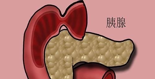 胰腺癌|查出癌症晚期,还有没有必要治疗答案很直白,别不接受