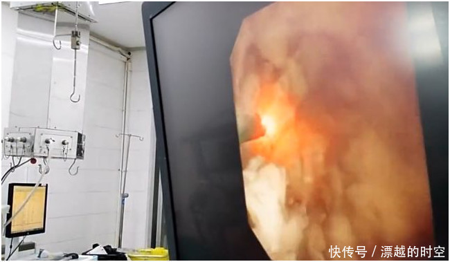 结石|2岁儿童“尿尿”疼!医生检查后吓出一身汗,家里有它趁早扔掉