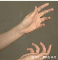 预防血栓|如果体内有血栓，观察手脚就知道，三个小动作，冲洗血管远离血栓