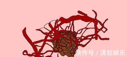 肿瘤患者|治疗癌症,并不只有手术和化疗,中医也能应对癌症,抵抗肿瘤