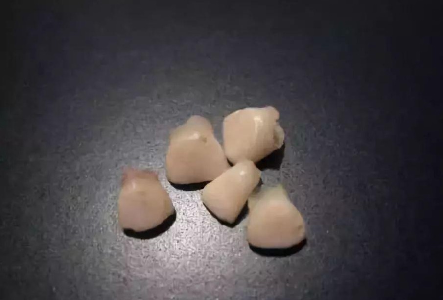 钱包君|宝宝乳牙掉了不要扔,重要时刻能救命现在流行的存乳牙真靠谱吗