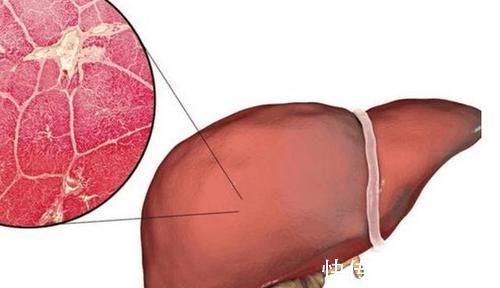 糖尿病人|半夜醒来，如果有口发干，口苦，也许这三种病都来就诊