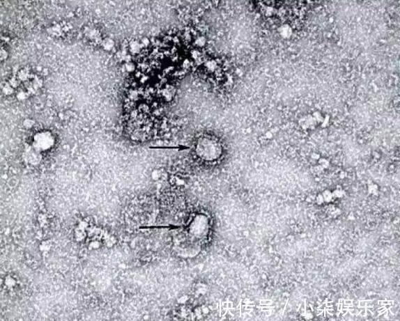 病毒|新型冠状病毒来自艾滋病毒人为改造这消息到底真实不真实