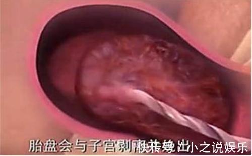 用力过猛|胎儿那么大,如何从那么小的产道出来看完知道女人有多伟大!