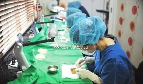 毛囊 植发科普植发原理?带你揭秘植发手术完整流程