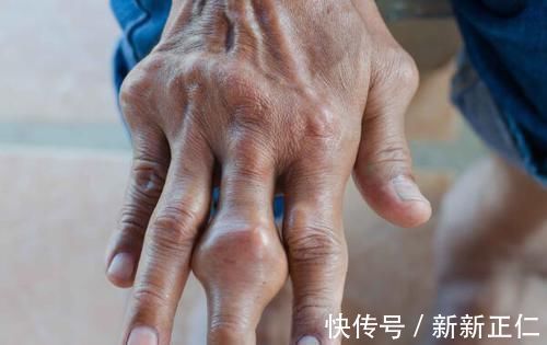 检查|身体出现这5种症状，或暗示你肺癌将至，趁早检查