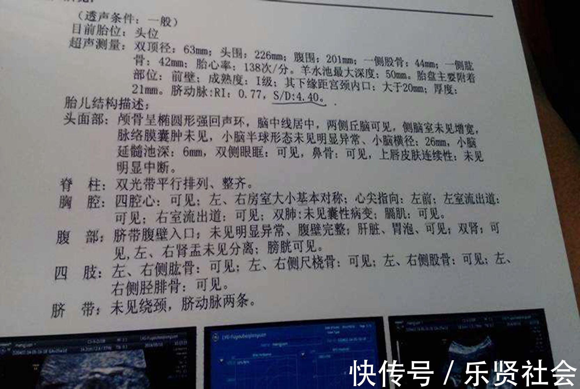 胎儿|怀孕后内裤有异样？可能是胎儿发出的警告，孕妈要懂“内裤隐忧”