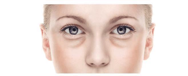 眼袋|为啥用了眼霜眼部状态还是不够好?看完你就明白了!