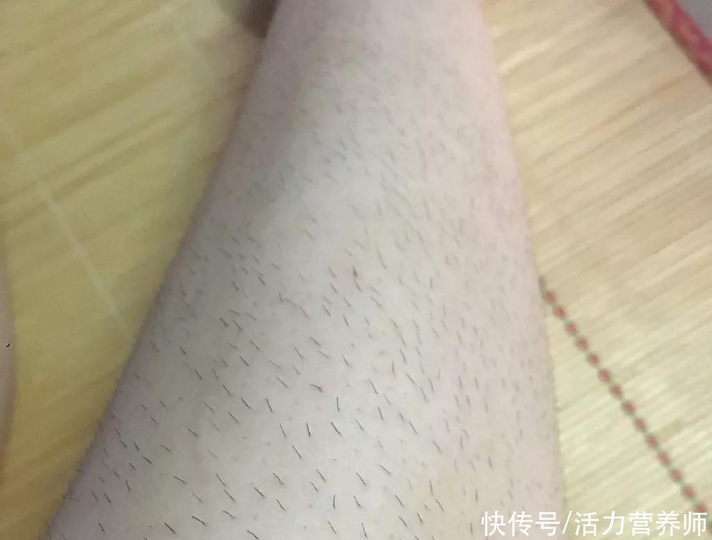 身体不适|为什么有些人汗毛是白的,还有些人是黑的?哪种视为正常现象?