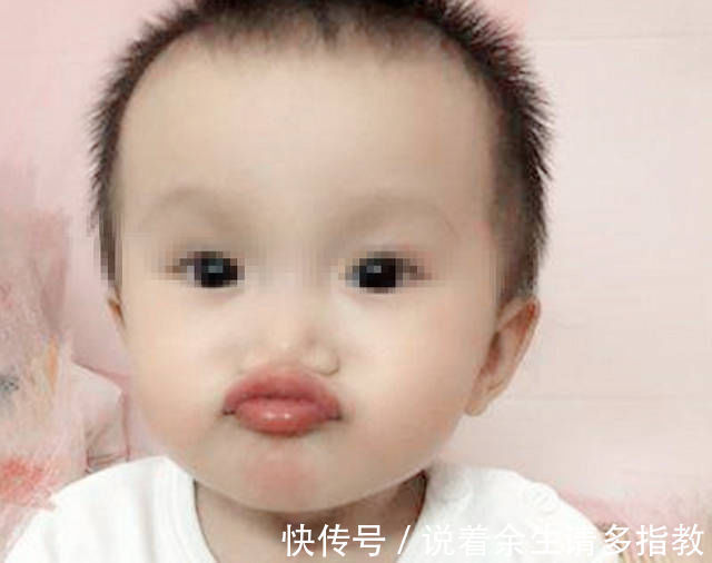 宝宝|2岁儿子总学“金鱼嘴”,全家都说好玩,奶奶一掰开嘴直奔医院