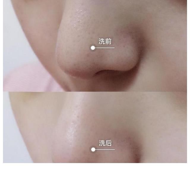 致癌物|洗面奶“查出”致癌物！瞧一瞧“黑名单”上有没有你的常用款吗