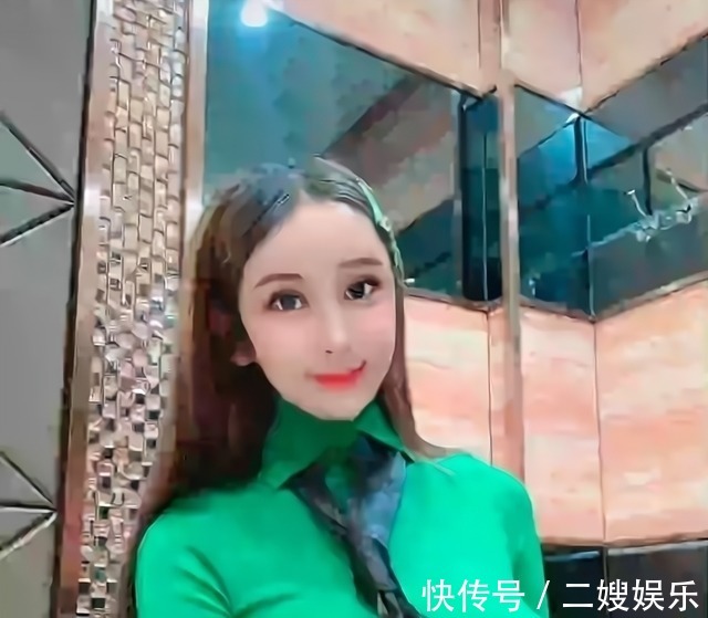 东北女孩 8年的整形手术花费了100多万,光额头就打了200多支玻尿酸