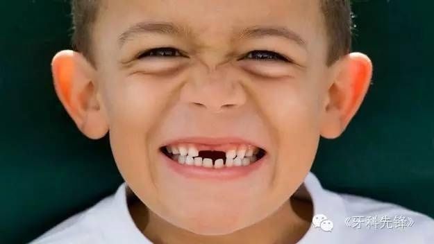 儿童|儿童换牙期六大注意事项，关乎孩子一生