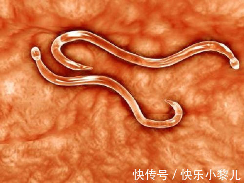 感染率|2岁女儿患上“蛲虫病”,得知原因后,宝妈直接气得带孩子回娘家