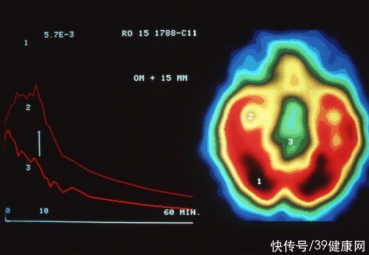 白质|男性和女性的大脑不同吗？了解男女的思维差异，成为沟通高手