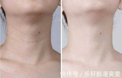 护肤 建议女人护肤品，最好不要成套！这样“混搭”，护肤效果会更好