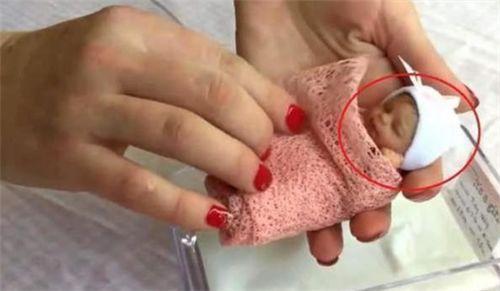 准妈妈|14年过去,原本身体巴掌大“世界最小宝宝”,如今颜值高到认不出