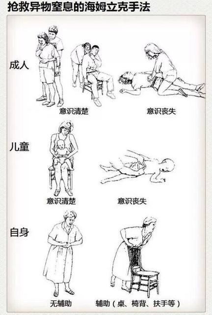 冲击|如果没有这个老师,孩子可能就死了,由此可见急救常识的重要性