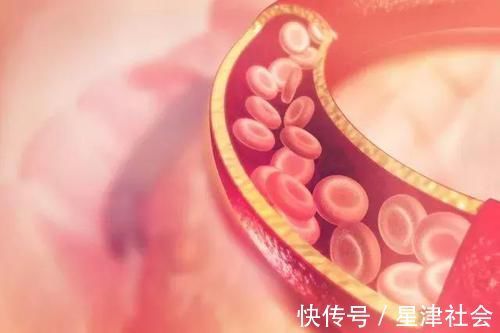 中老年人|身体出现这4个迹象，说明你的血脂超标了，别让心梗趁虚而入！