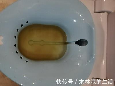 肛門腫痛|得了痔瘡怎么辦？肛腸專家：2個方法這么用，痔瘡肉球沒了！