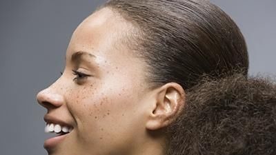 叶天士|注意了,补气血的组合来了,照着这样吃,活血化瘀,色斑也淡了