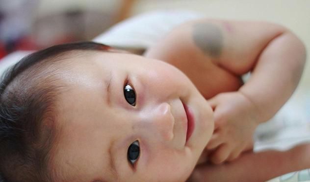 产科医生|胎记是怎么回事产科医生孕期尽量避开3种行为,以免胎儿自卑