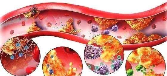 难吃|一旦查出高血压，难吃也要多吃“它”，增强血管弹性，血压更稳定