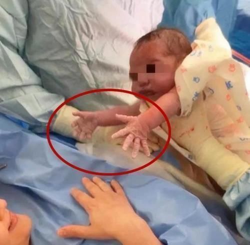 妈妈的味道|“粘人宝宝”火了,一出生就向妈妈索要“抱抱”,医生拦都拦不住