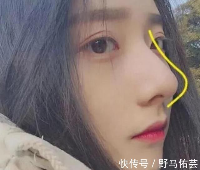 油脂|鼻子上总是挤出“白色条状物”学会这3招,和“草莓鼻”说拜拜