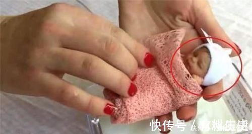 颜值|14年过去,原本身体巴掌大“世界最小宝宝”,如今颜值高到认不出