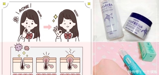 就算长痘痘,也照样保湿!冒痘时可以使用的保湿产品大公开