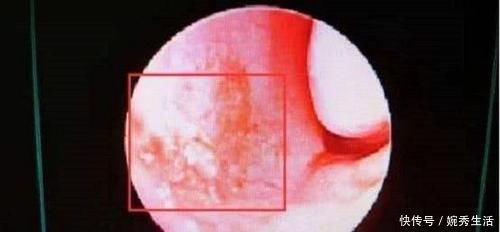 小常识|4岁男孩鼻血不止,送医院被告知“无法抢救”,只因宝妈这一举动