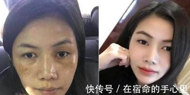 痘痘|每天“花椒水”加它敷脸,坚持7天美白祛斑,还能去除痘痘!